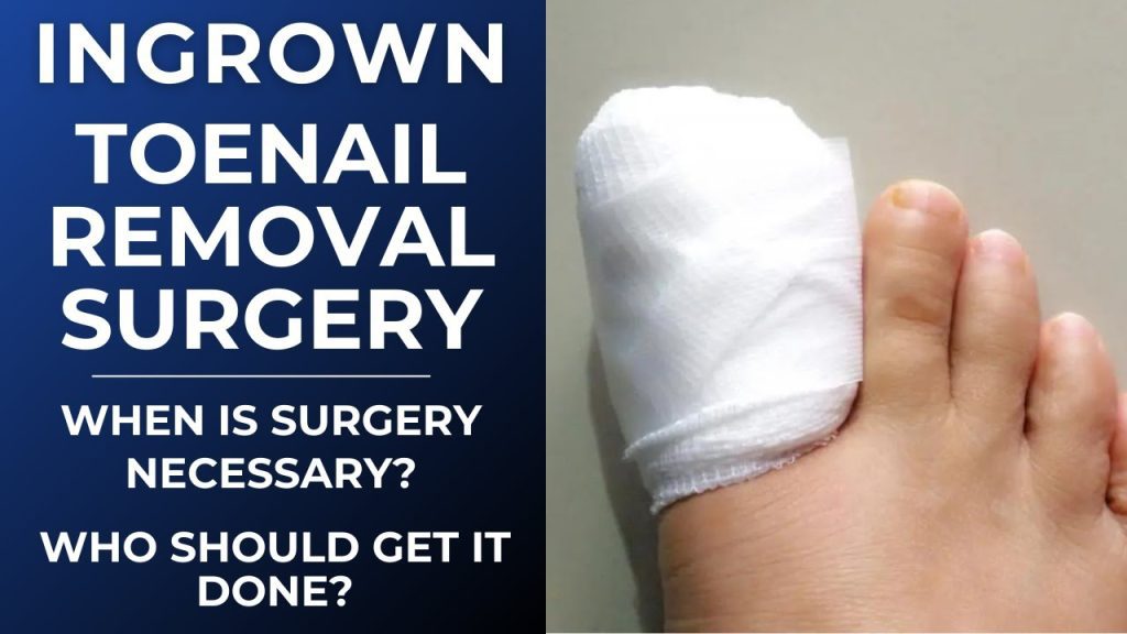 What Infection Symptoms Should Prompt Immediate Care from an Ingrown Toenail Doctor